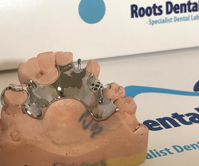 rootsdental's tweet photo. So difficult to capture how shiny our mirror finish chromes - happy lab , get your pack today for lab2lab or your practice.  #Dentist #dentallab #dentallaboratory #privatedentist #dentistry #digitaldentistry #dentaltech #dentaltechnology #dentaltechnician #dentaltechnicians … https://t.co/RM3VKizIl0