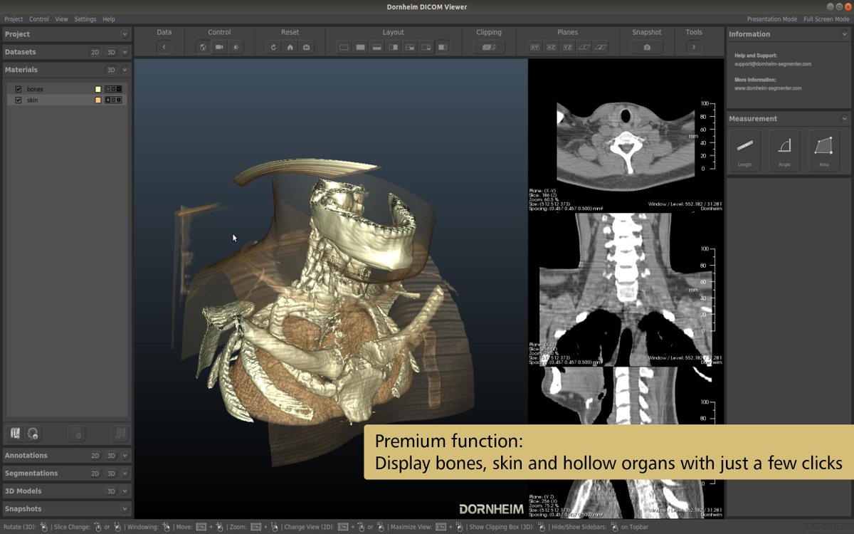 DornheimMedical's tweet photo. The Dornheim DICOM Viewer® offers you a high-class 3D representation of your #DICOM images, such as #CT and #MRI scans, but also 3D ultrasound. Download now (for free) https://t.co/iF9ygYWIIS https://t.co/vSKFD0Q7sl