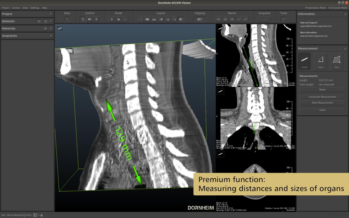 DornheimMedical's tweet photo. The Dornheim DICOM Viewer® offers you a high-class 3D representation of your #DICOM images, such as #CT and #MRI scans, but also 3D ultrasound. Download now (for free) https://t.co/iF9ygYWIIS https://t.co/vSKFD0Q7sl