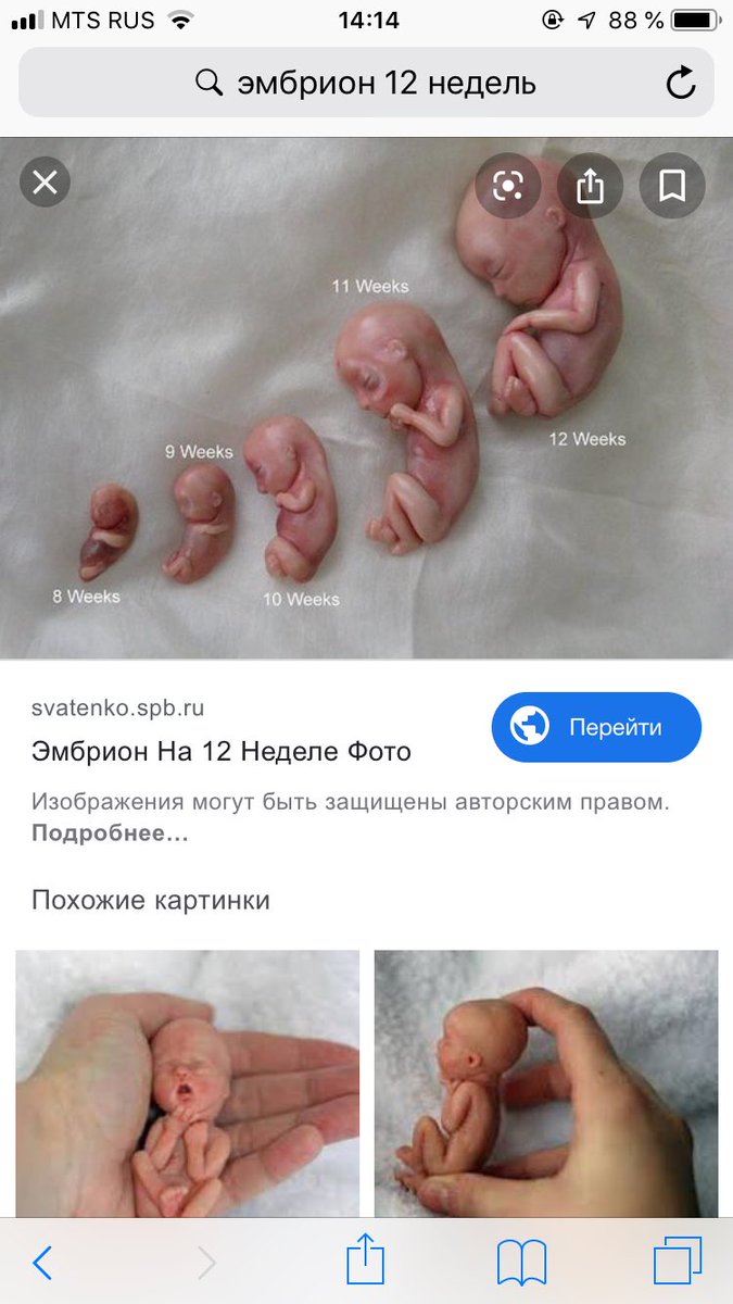 Течение беременности у человека — Википедия 11 неделя беременности