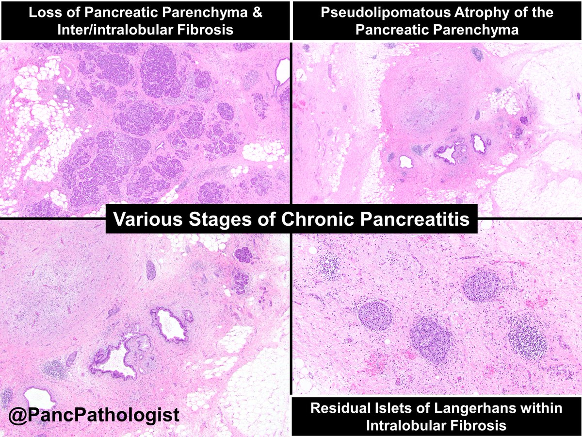 PancPathologist tweet picture