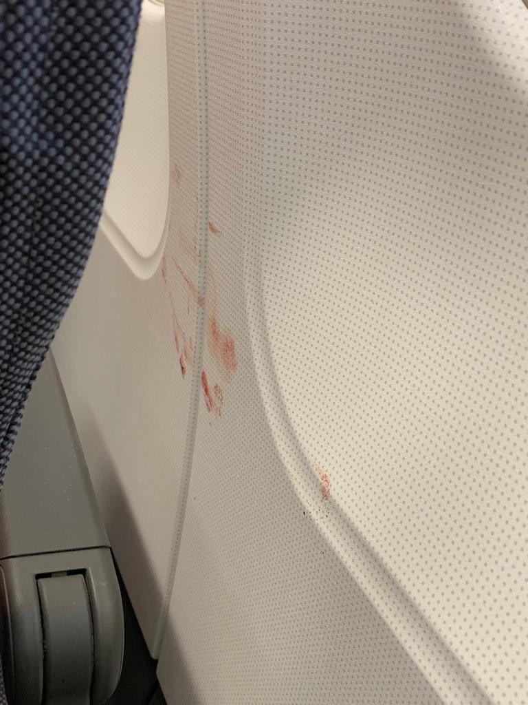 ⁦<a href="/SAS/">SAS - Scandinavian Airlines</a>⁩ I appreciate you guys are tight on time between flights but if I point out blood smeared next to the seat it would be nice to have it cleaned.