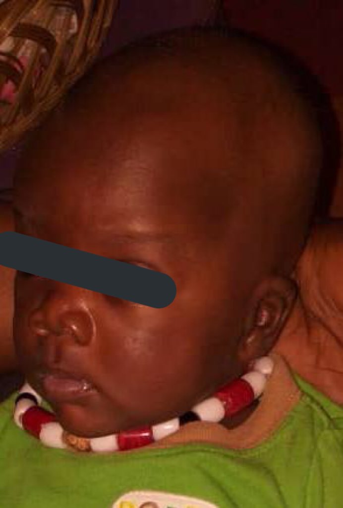 Makhfouss2's tweet photo. Salut la famille,
Cet enfant agé de 7mois du nom de Babacar Ndiaye a perdu sa maman et son jumeaux a l'accouchement, il a été récupéré par sa grande mère qui peine à le mourir. 
Ce bébé orphelin a vraiment besoin de lait nursi, couches, céréales et habits.
Tout ce qui veulent https://t.co/SDArA8pldB