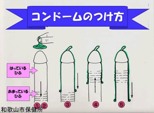 コンドームの付け方 ユナイテッドクリニック