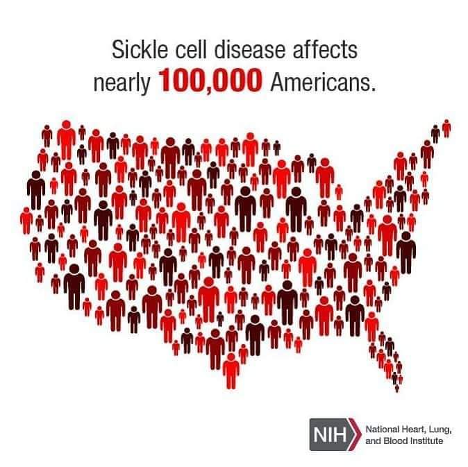 SickleCellMN's tweet photo. Today may be the last day of Sickle Cell Awareness Month, but the work that we do as a community lasts all year round! #TimeForACure #ConquerSCD #SickleCellMN https://t.co/fkHWcDXBNV