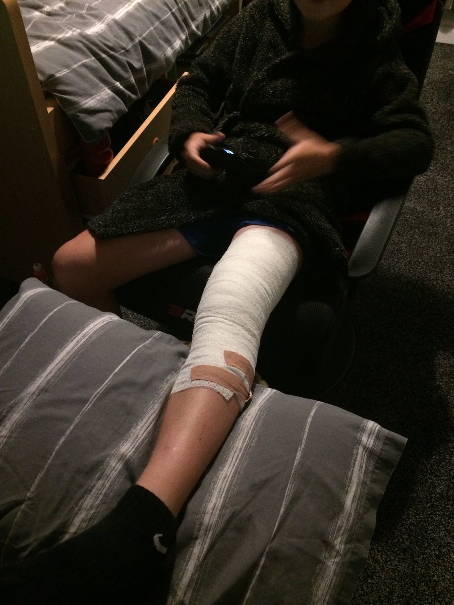 critoph1980's tweet photo. @TheF2 MAXIMUS first football injury torn ligament in knee no football for least 6 weeks 😢 https://t.co/62jvjSE4Mh
