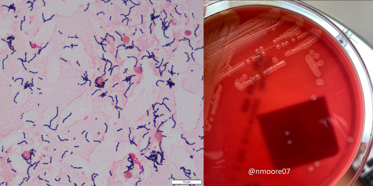 nmoore07's tweet photo. #MicroRounds Day 46: case from Peds ID: 33day old female with a temp of 101F @ home.  Brought to ED w/ cough, congestion, ⬇️ PO intake.  WBC @ 21K, blood cx pos after 12 hours.  Full term via C-section.  What's the most likely organism?  #IDpath #medtwitter #ASMClinMicro #pedsID https://t.co/2DcUVgxkTH