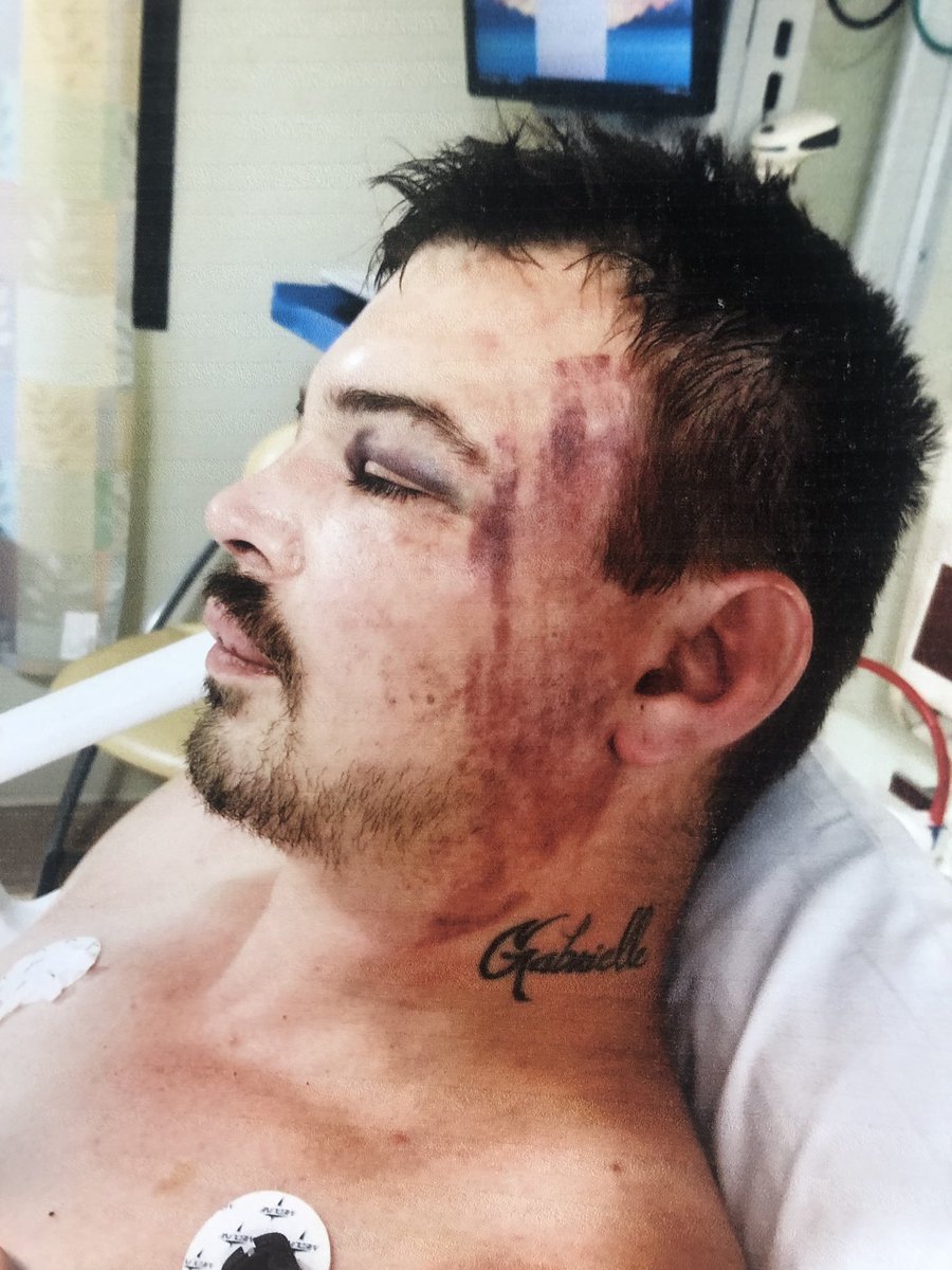 Toledo Police Officer Jeffery Lepiarz caught on tape savagely beating John Lorenzen (a mentally -ill man) who was suffering from a ‘Medical crisis’ To justify this beating me he Officer turned around and charged him with multiple bogus felonies. #toledo419 #ToledoPolice