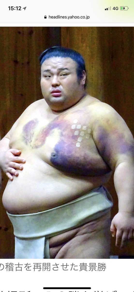 貴景勝の左胸の大きな痣が丸で和彫りのように見える Togetter