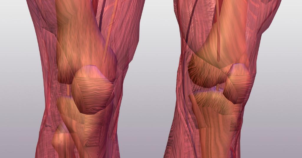 For every pound you lose, it takes 4 pounds of pressure off your knees and 6 pounds off your hips. wb.md/2mkbqUq