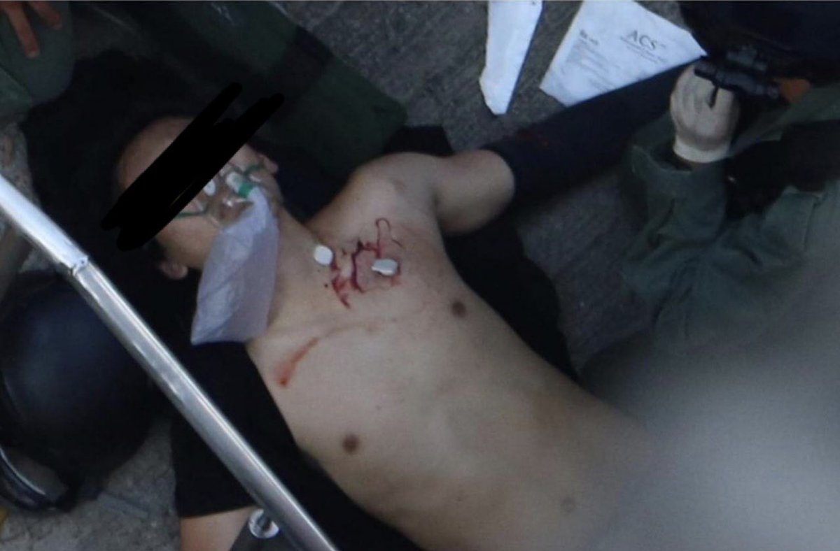 _Fabyanchuk's tweet photo. #HongKong police carried out massive attack on CCP’s 70th anniversary to kill our opposing voices. #HongKongProtesters got shot in the lungs and eyes intentionally by the police.

#PoliceBrutality #PoliceTerrorism #PoliceState #NotMyNationalDay #GoodMourningCCP https://t.co/lo39YKWrFc