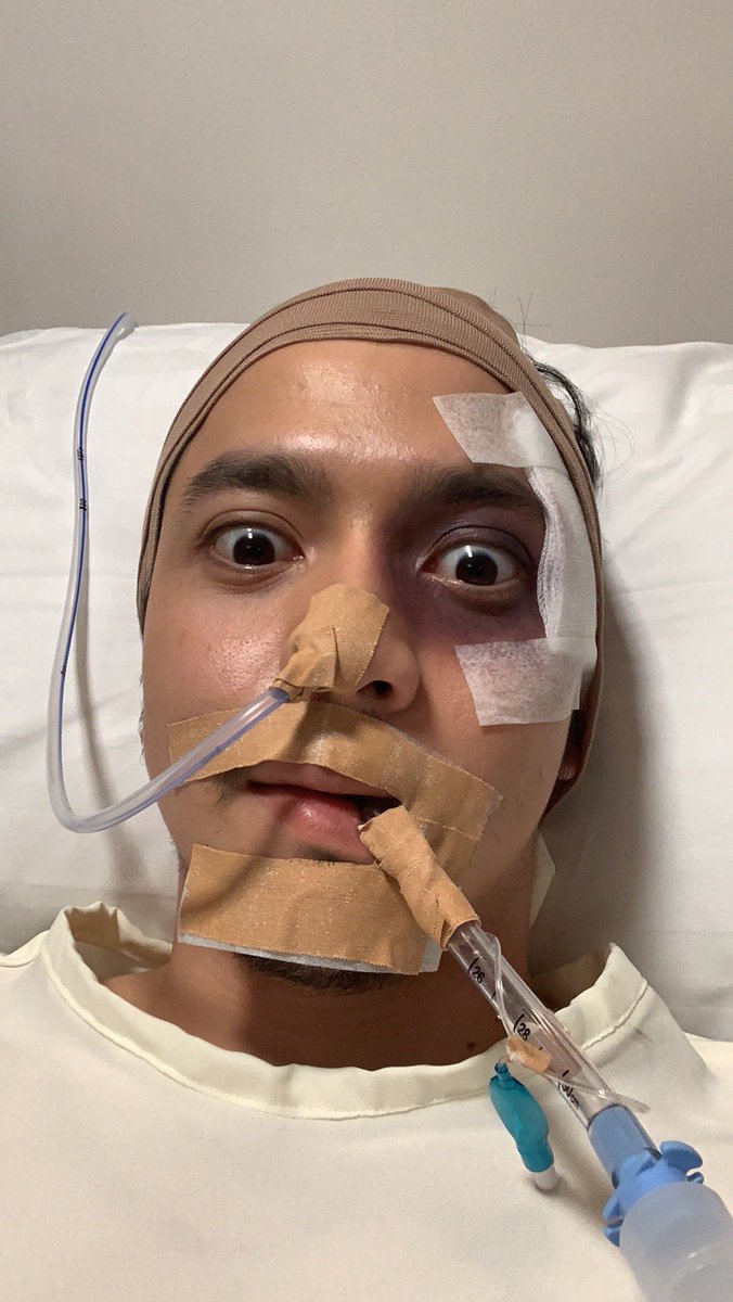 Mag ready na po kayo lahat bukas. #TheGiftKapitLang 😢