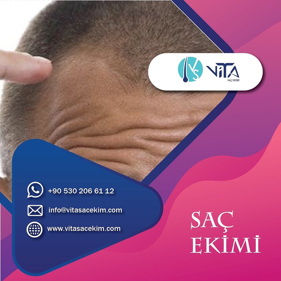Saç, Sakal, Kaş Ekim Hizmetleri. 0530 206 61 12 #saçekim #saçekimmerkezi #prp #fue #istanbulsaçekim #ankarasaçekim #izmirsaçekim #saçekimturkey #istanbuldasacekimi #saçekimibursa #saçekimikırşehir #saçekimimalatya #sacekimiedirne #batmansaçekim #kastamonusacekimi #konyasaçekimi