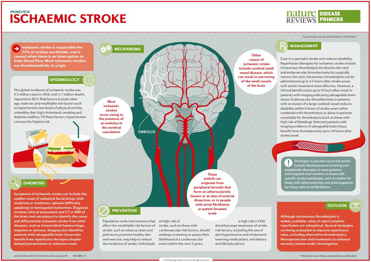 DiseasePrimers's tweet photo. Most ischaemic #strokes occur owing to the presence of an #embolus in the cerebral vasculature https://t.co/W7GY6IlJKr https://t.co/5WOCeOt3bA