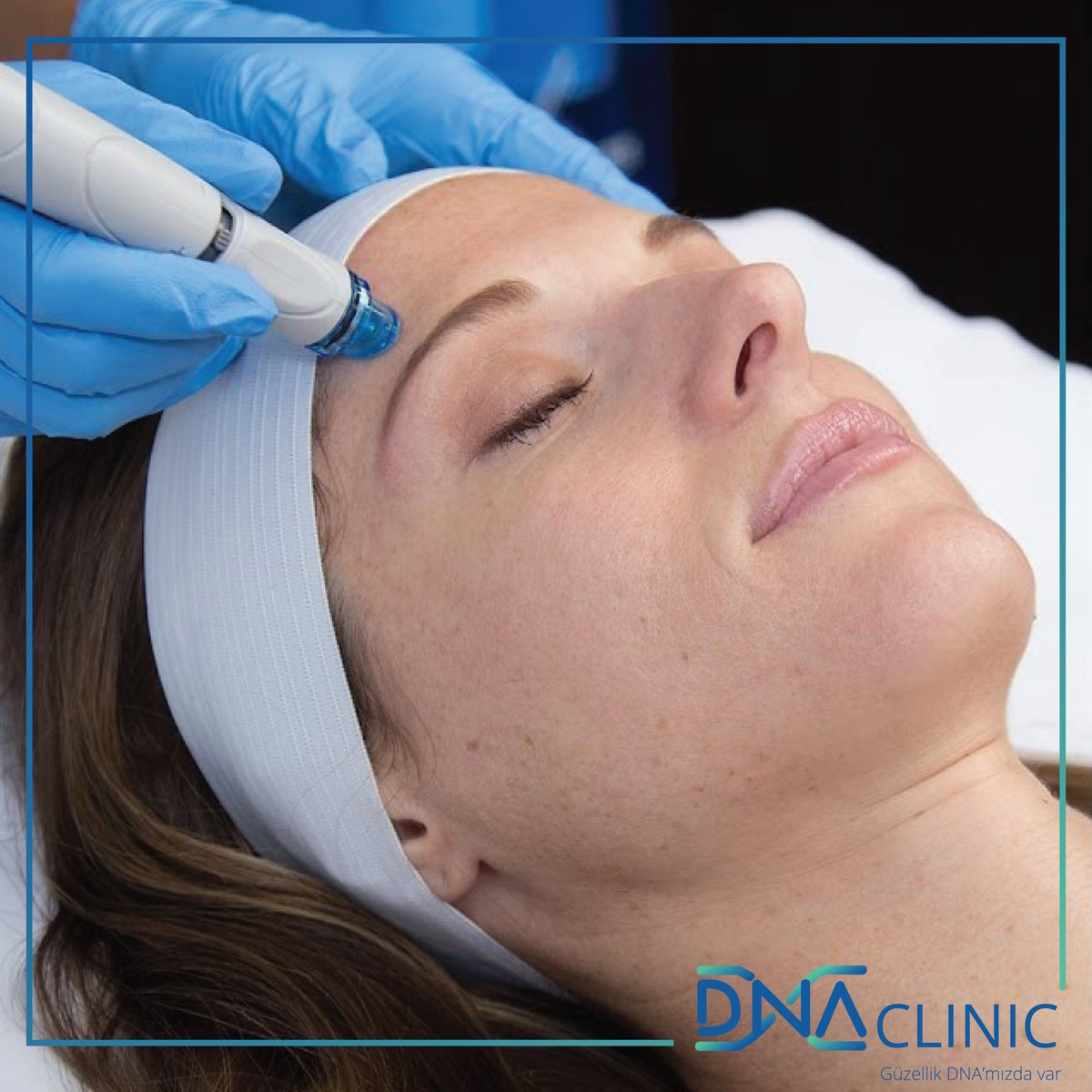 #Hydrafacial #cilt_bakımı vakum aşamasında; Gözenekler ağrısız bir vakumlama ile temizlenir, cilt hyaluronik asit bileşenleri ile nemlendirilir.🤗
Nişantaşı: 0532 460 11 79
#ciltbakimi #dnaclinic #güzellik #guzellik #makeupartist #nişantaşı #nisantasi #istanbul #kayseri