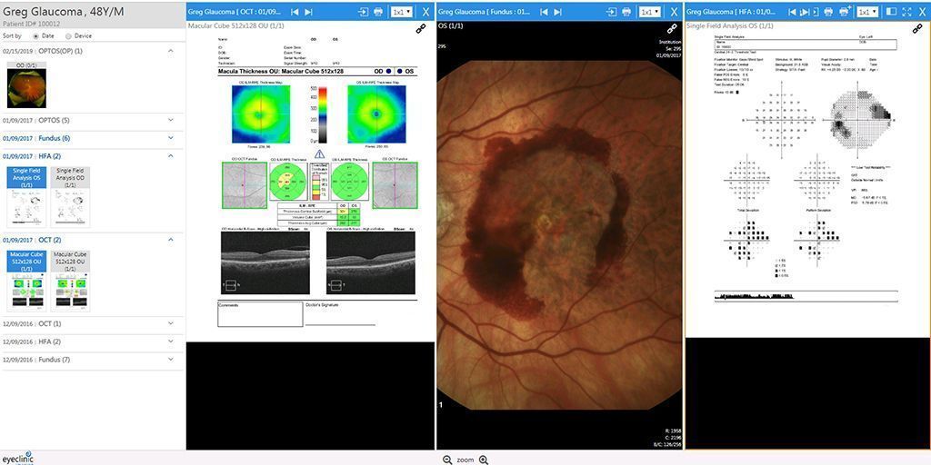 First_Insight's tweet image. Spend less time searching for patient images and reports from #imagingdevices with EyeClinic Imaging. Works with any #ophthalmic #EHR, demo at @aao_ophth booth 5619. buff.ly/2KLKtDX  

#ophthalmology #imagemanagement #AAO2019
