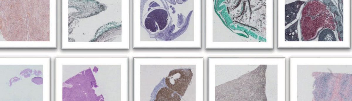 Richard Salmon, Product Manager - Life Sciences at FFEI,  discusses why colour standardisation of whole-slide digital imaging is essential to reliable computer-aided diagnosis #calibration #pathology #digitalpathology lnkd.in/g4YK8is