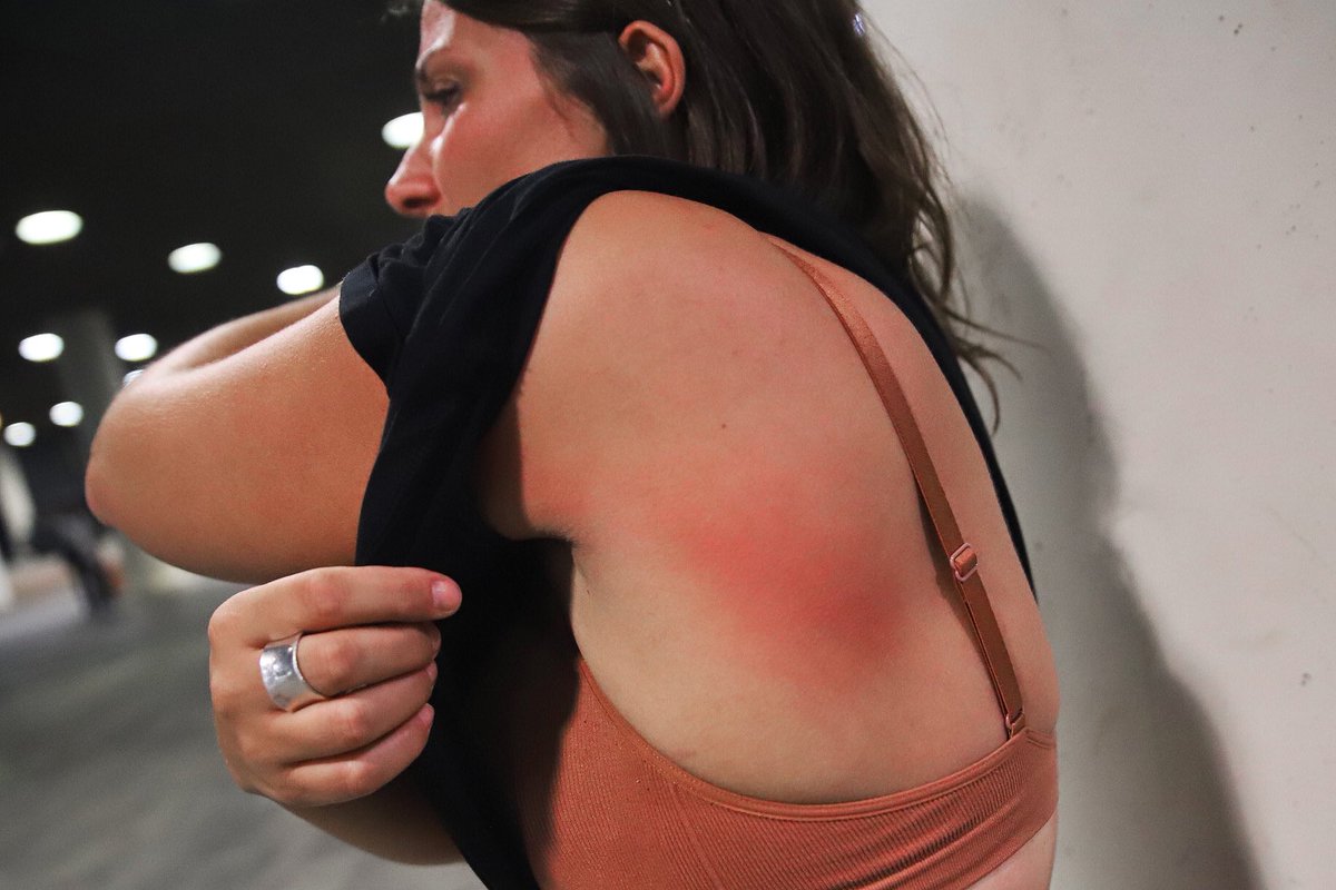 Agents de la Brimo agredeixen amb porres en dues ocasions a la periodista francesa <a href="/EliseGaz/">Elise Gazengel</a> tot i dur el braçalet i cridar que era premsa. També l’han colpejat a l’ordinador <a href="/periodistes_cat/">Col·legi de Periodistes de Catalunya</a> <a href="/GrupBarnils/">Grup de Periodistes Ramon Barnils</a> <a href="/periodistescat/">Sindicat Periodistes</a>