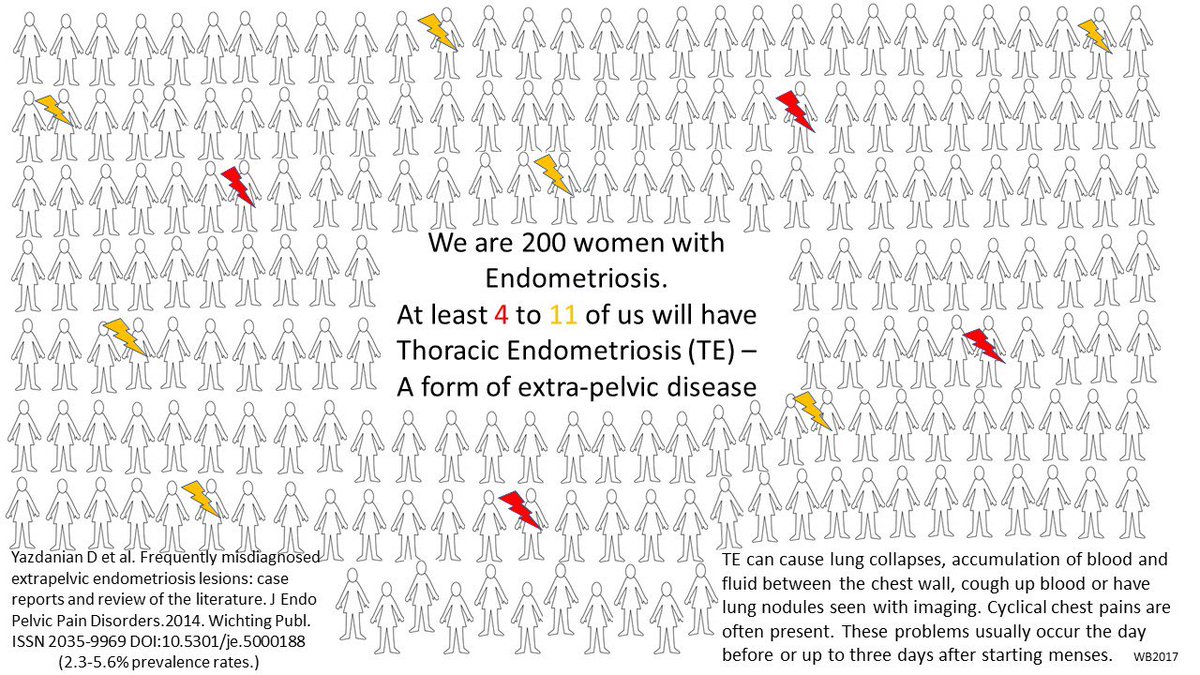 XtraNotRare's tweet photo. #endometriosis: NOT ltd to the female reprod. syst. #extrapelvicendometriosis tradit. considered ‘rare’, WHY? A few reasons: #underrecognized #underdiagnosed #undereducated #medicalcurriculum #lackdiagnosticcodes #researchresources #myths #misinformation (images r Conserv ests.) https://t.co/2w0Xj7TpLu