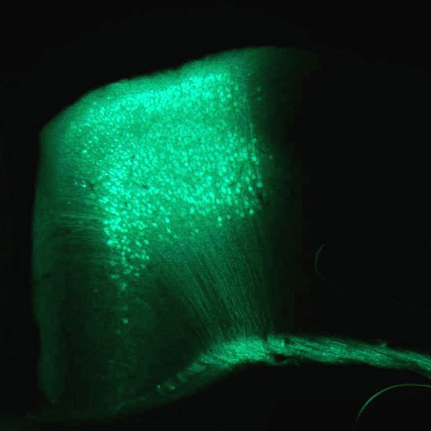 AmuzaInc's tweet image. Several users of our O’Hara #BehavioralTesting systems are presenting their research at #SfN2019 this year! Check out what they’ve been working on.
#Neuroscience #Behavior #SocietyForNeuroscience #AmuzaInc
ow.ly/28nS50wL5Nn