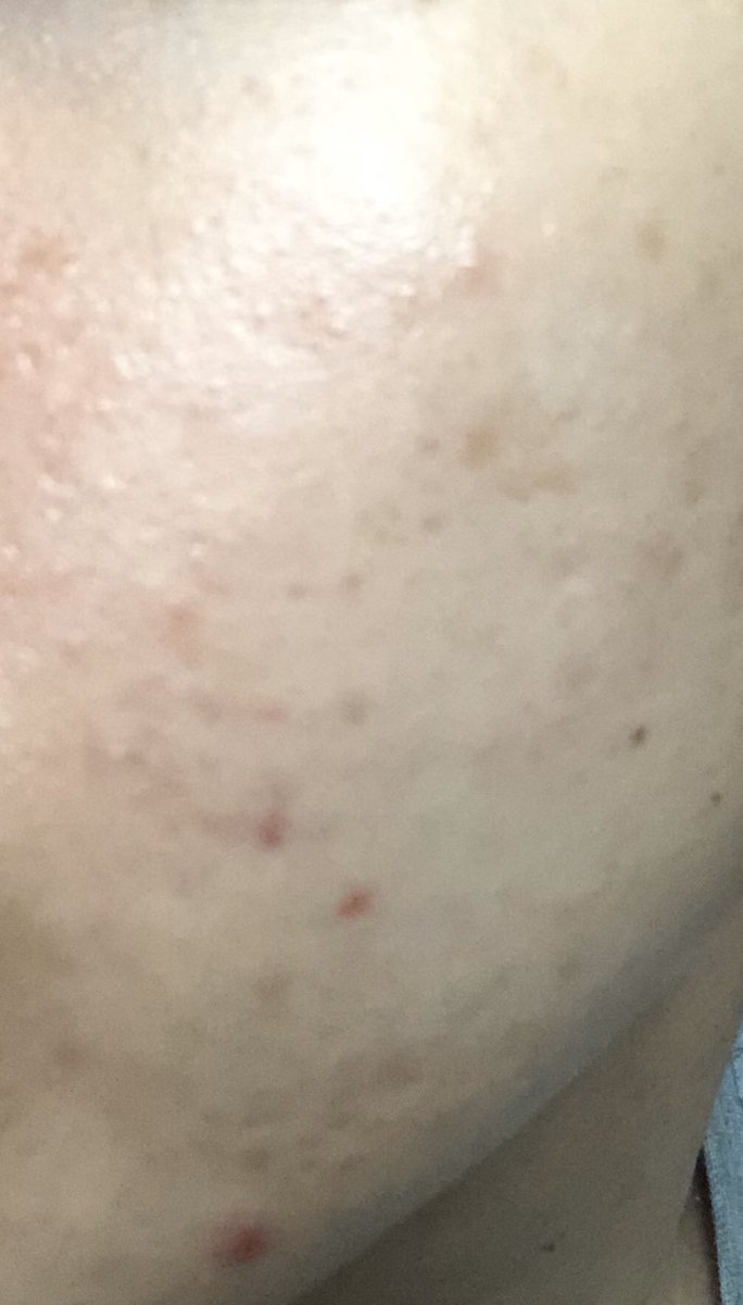 肌のごわつき Hashtag On Twitter