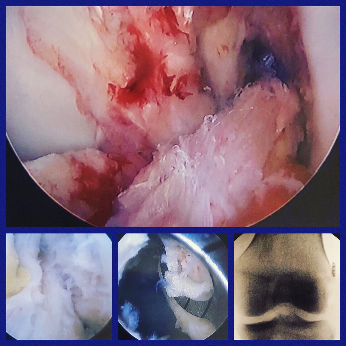 Karen Sutton, MD, FAAOS tweet media