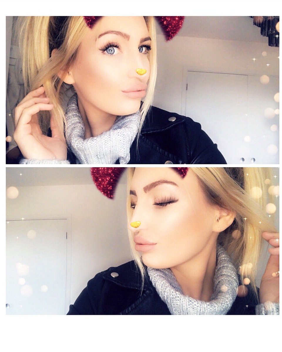 skyedurie91's tweet photo. Fresh lips though 💉😍 https://t.co/6UtSwgaF08