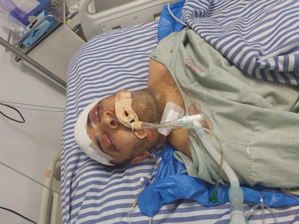 Ashok_Gupta_'s tweet photo. #SavePrashantMehta
Need Help - Urgent attention
Beloved Modi Ji / PMO/ Health Minister
Please provide airlifting from Ajmer to AIIMS -Delhi,  he is in coma and dying, critically injured
Father’s M 098113 63466
Hospital Name- Arya Neuro Spine &amp; Super Speciality hospital - Ajmer https://t.co/9h8oq2nUad