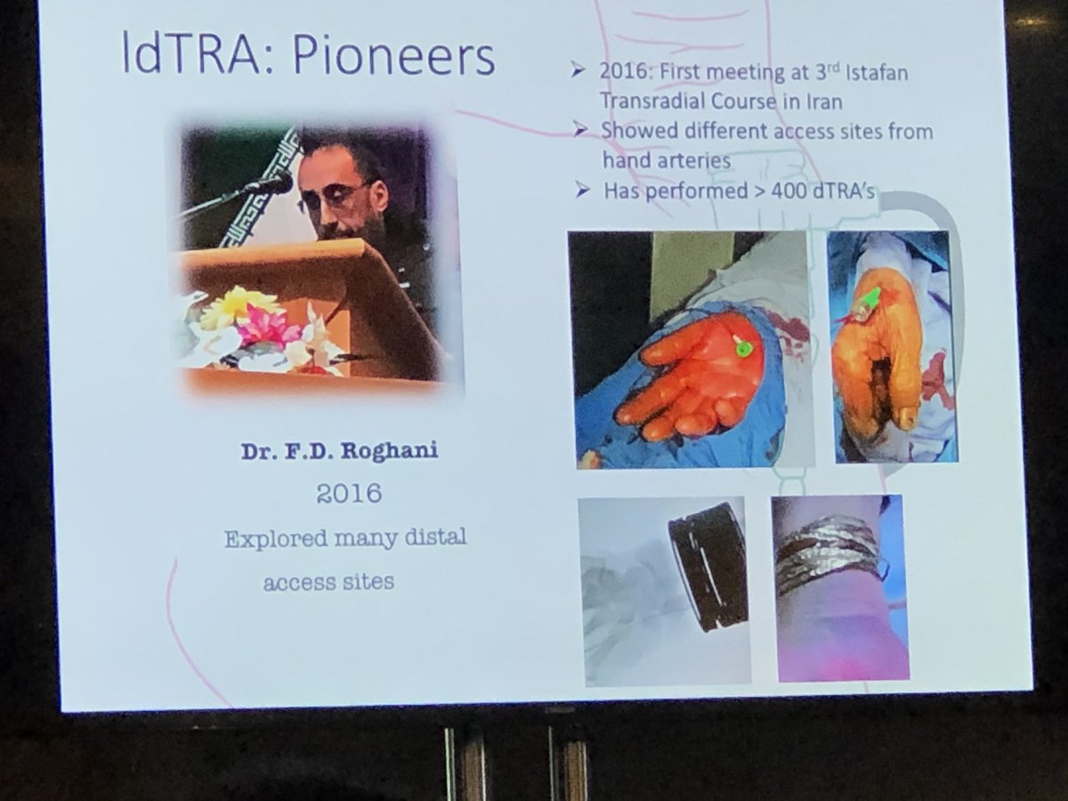 stefan_harb's tweet photo. @ferdikiem and other pioneers of distal radial access #radialfirst #ldTRA #ldTRI #rdTRA #rdTRI https://t.co/BBRc3NVKUq