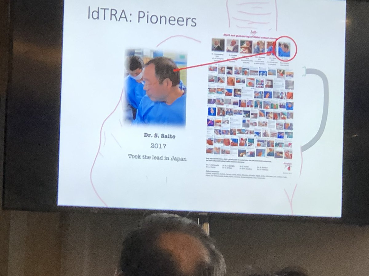 stefan_harb's tweet photo. @ferdikiem and other pioneers of distal radial access #radialfirst #ldTRA #ldTRI #rdTRA #rdTRI https://t.co/BBRc3NVKUq