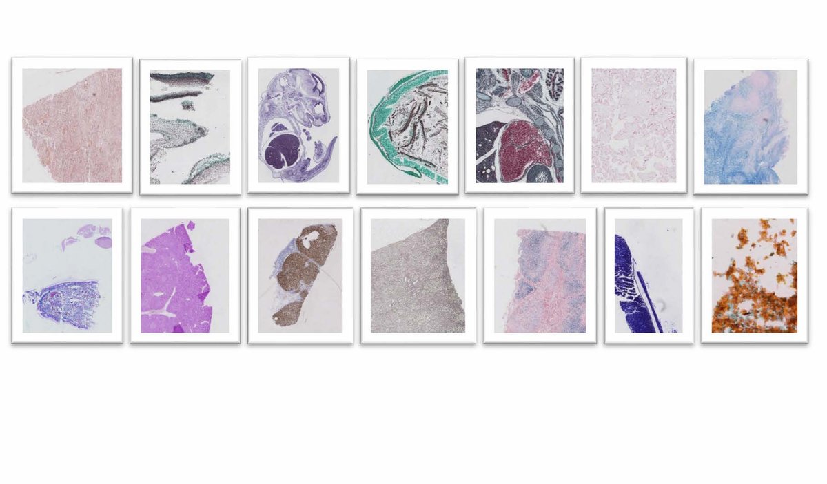 Richard Salmon, Product Manager - Life Sciences at FFEI,  discusses why colour standardisation of whole-slide digital imaging is essential to reliable computer-aided diagnosis #calibration #pathology #digitalpathology ffei.ai/2019/10/15/the…