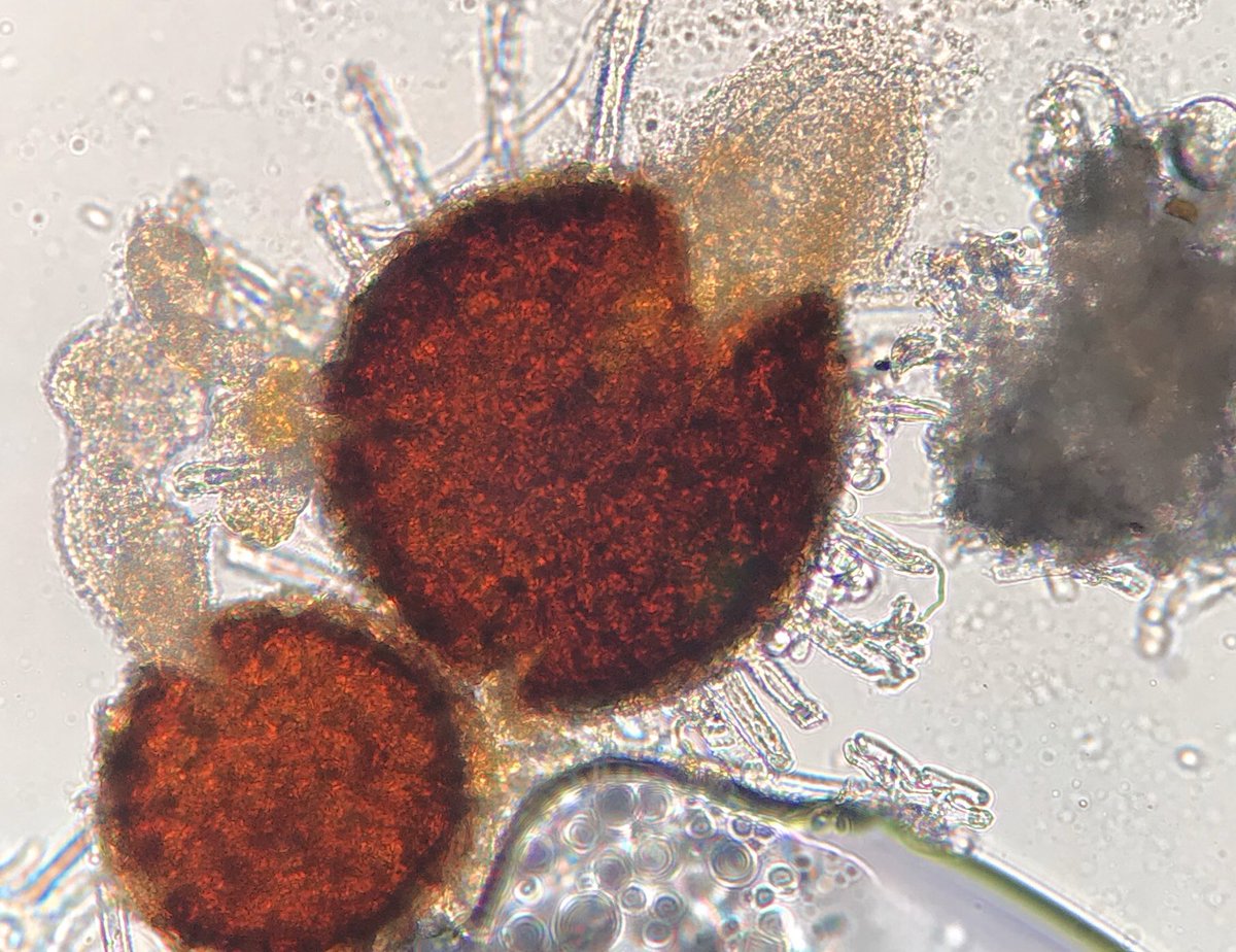 AlexWongScience's tweet photo. Week 3 of #BOT350 sexual structures of ascomycete plant pathogens. Chasmothecia of powdery mildews and stroma of eastern filbert blight loaded with perithecia. https://t.co/SEzRVPLShk