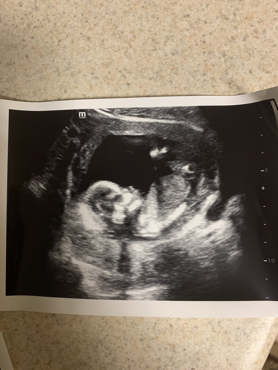 Ahmada 🌹 tweet media