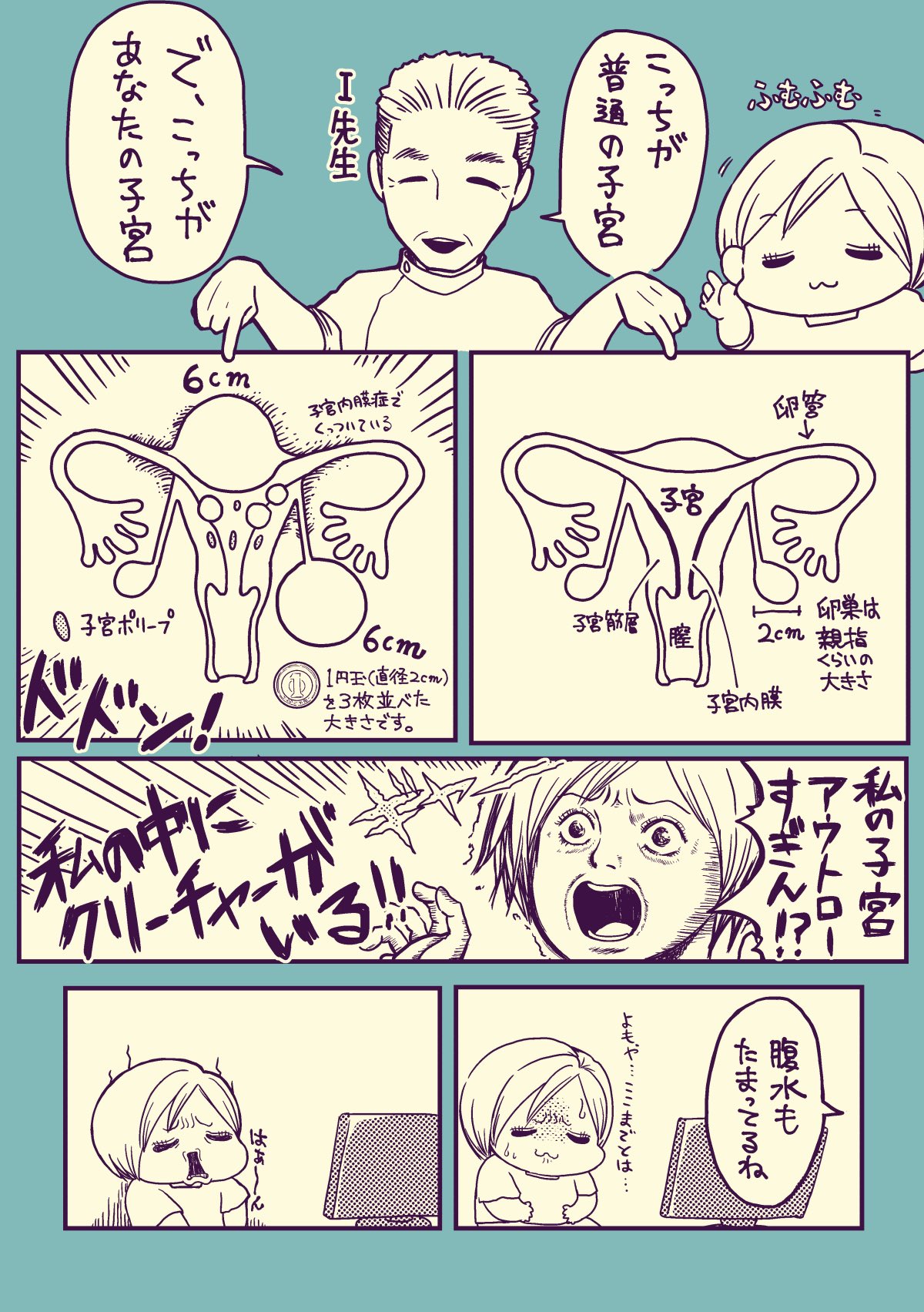 Piqel Piqerm ピケルピケルム Pa Twitter 41歳 独身 子なしが子宮筋腫と卵巣のう腫で開腹手術で子宮全摘するよ 2 タイトルそのままの手術 入院のレポ漫画です 私が子宮全摘を選んだ理由 子宮筋腫 子宮全摘 T Co Ygarwcajmj Twitter