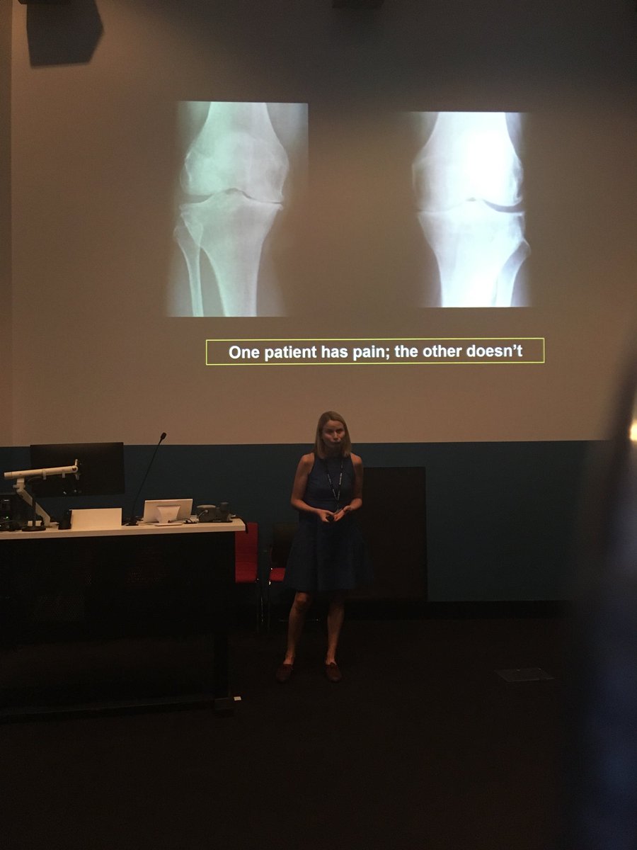 DiPerriman's tweet photo. Tasha Stanton @ANZORS_ asks why some people with dreadfully deranged joints don’t have pain while others do. https://t.co/vLx1odQ7xQ