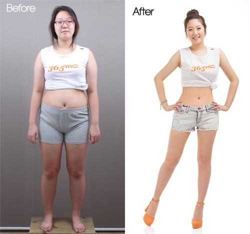 Only LAMS, can make Amazing Change. #Obesity_surgery at 365mc hospital is very popular in South Korea. 💯All types of obesity surgery, #consultation and #procedures are available. 🎗Why 365mc? its the very first & the only #obesity_center in Korea snip.ly/4oe3rs #lams