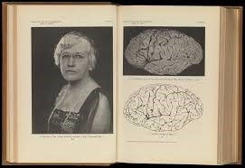 Elise Padbury is a PhD student with Department of Biological and Medical Sciences <a href="/oxford_brookes/">Oxford Brookes University</a> Her STEM hero  Helen Hamilton Gardener, in the early days of neurology and brain anatomy, disputed the assumption that brain size determined intelligence.  
en.wikipedia.org/wiki/Helen_H._…