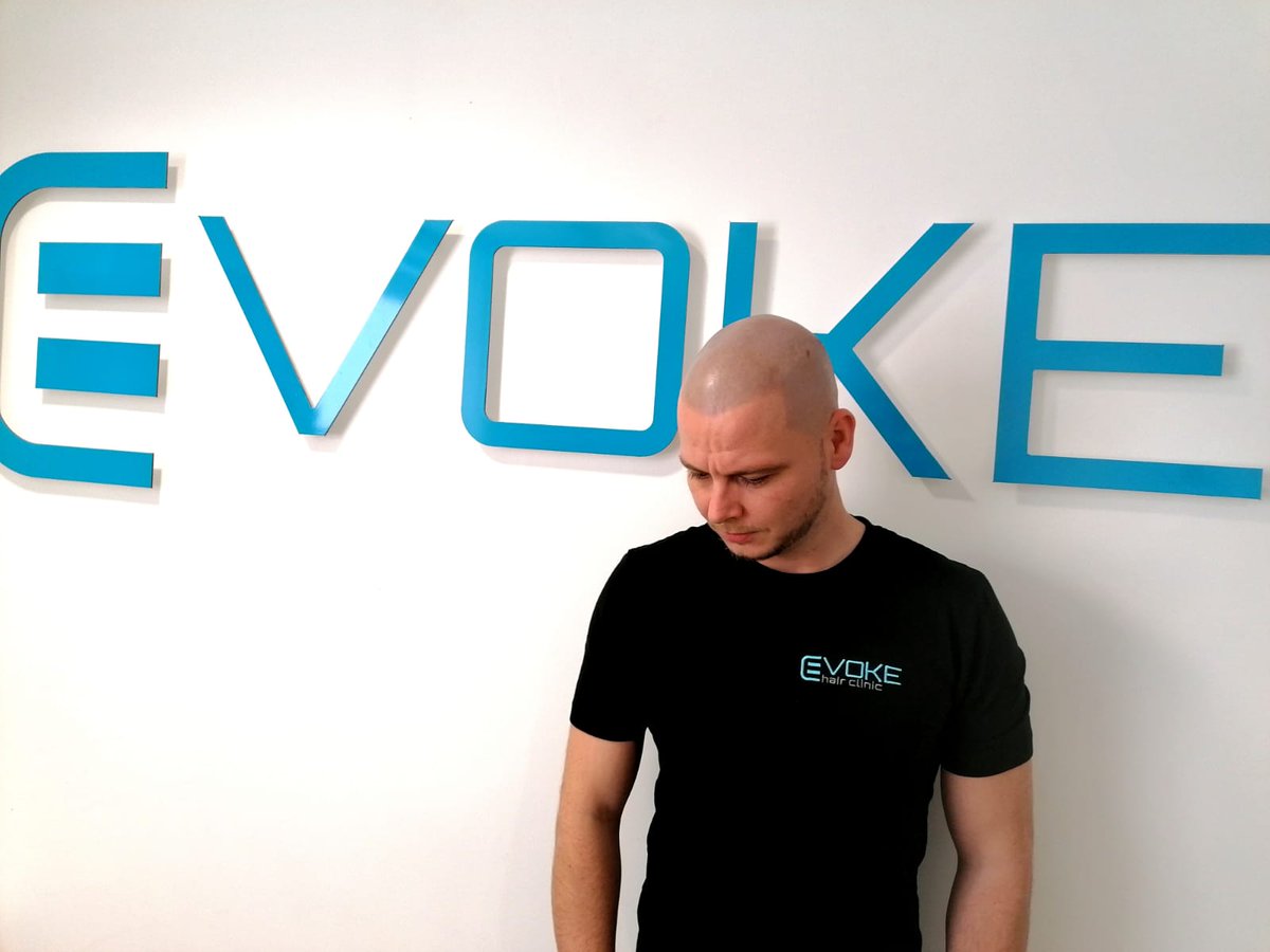 evokehairclinic's tweet image. Our consultant technician Nick, fresh from his top up with our very own Adam. Looking good! #smp #scalpmicropigmentation #scalppigmentation #hairtattoo #hairlinetattoo #malepatternbaldness #balding #evoke #sheffield