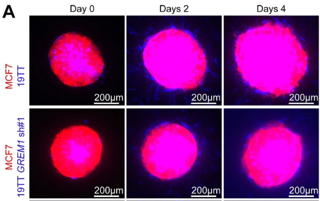 BreastCancerResearch (@bcrjournal) on Twitter photo The association of BMPs and antagonists to #breastcancer may be a form of targeted therapy for patients: bit.ly/2ognQh3 #Genomics #Analytics #openaccess <a href="/oncodeinstitute/">Oncode Institute</a> <a href="/ErasmusMC/">Erasmus MC</a> @unimelb #FridayMotivation #BreastCancerAwarenessMonth The association of BMPs and antagonists to #breastcancer may be a form of targeted therapy for patients: bit.ly/2ognQh3 #Genomics #Analytics #openaccess <a href="/oncodeinstitute/">Oncode Institute</a> <a href="/ErasmusMC/">Erasmus MC</a> @unimelb #FridayMotivation #BreastCancerAwarenessMonth
