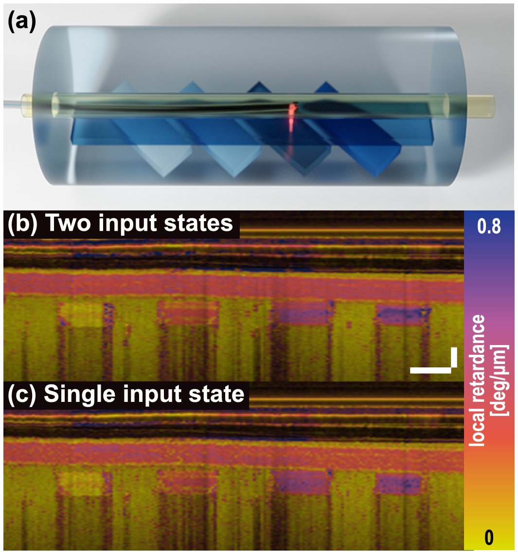 OpticaPubsGroup's tweet photo. via #OSA_BOEx: Constrained polarization evolution simplifies depth-resolved retardation measurements with polarization-sensitive optical coherence tomography https://t.co/Et688VxJDT #PolarizationState @NTUsg @MIT https://t.co/HTd5l63gos