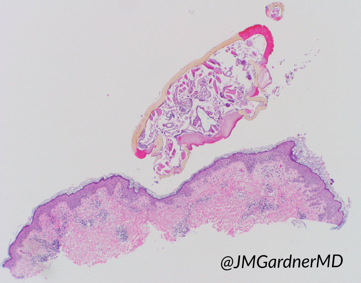 JMGardnerMD tweet picture
