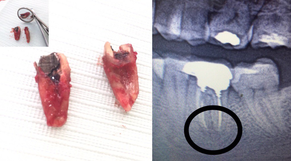 Dr.Hesna Huseyni (@hesnahuseyni) on Twitter photo 