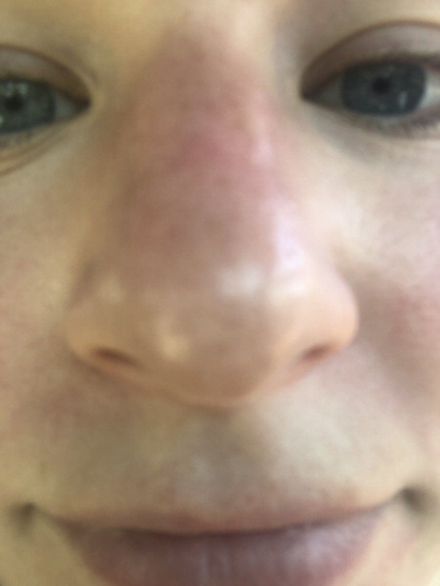 emalonez's tweet photo. me when the text is small on your instagram story https://t.co/7QTNNULiDK