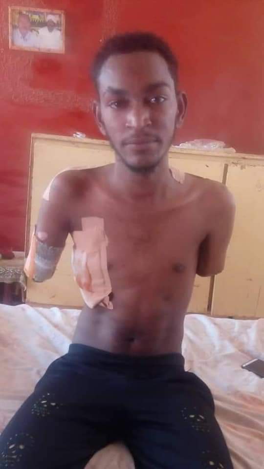 Muaz_Eltayeb's tweet image. لو سمحتو اي واحد شاف التغريدة دي يعمل ريتويت، دا شاب في عز الشباب فقد اطرافو  الاثنين طبعاً متخيلين الالم والمعانه قدر شنو 💔💔 حاجة مؤلمة جداً يحتاج لاطراف صناعية لممارسة حياتو الطبيعية "جنية بفرق يا اخونا"
للتواصل مع اسرة المريض : 00249925432500