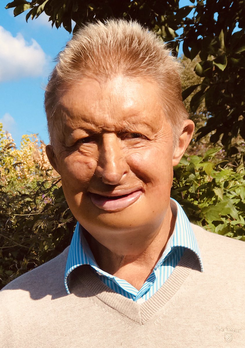 JRJPartridge's tweet photo. Did you know 1 in 700 babies are born with a cleft globally?
In honor of #WorldSmileDay I am standing with @SmileTrain who has supported more than 1.5 million cleft surgeries in more than 90 countries! #ICreateSmiles #1in700 https://t.co/Eij6Bgb9MX