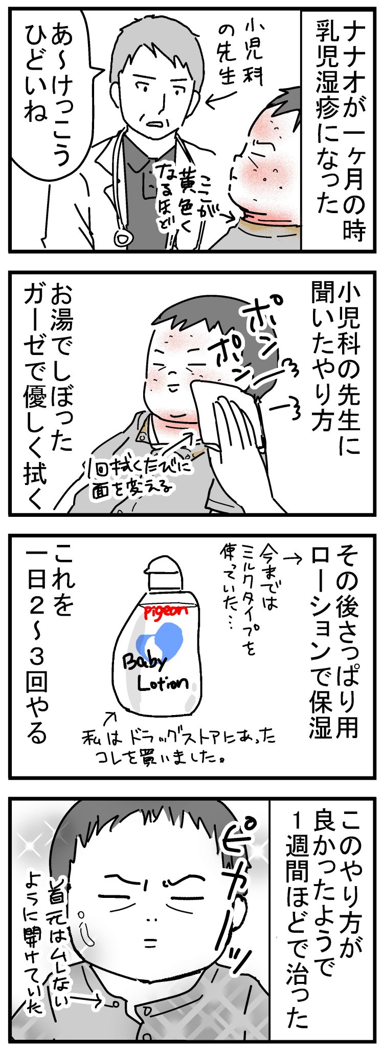 ちくまサラ 6y 1y 乳児湿疹と脂漏性湿疹になった話 乳児湿疹 このやり方でダメなら薬貰おうと思ったけど治って良かった 頭は オイルかけてしばらくおいてからしつこくモミモミでボロボロ取れました 髪の毛も取れて薄くなっちゃったけどまた生えてき