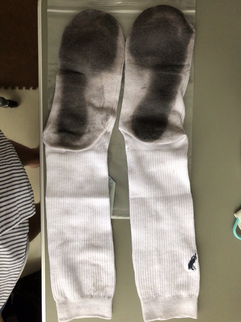 Weisse Socke V Twitter 白い靴底が黒いとき 私は女子学生の白い 汚れた 膝 靴下が大好きです 誰が私にそのような靴下 を売っていますか 私は汚い靴下フェティッシュで スイスに住んでいます すみません Googleで翻訳する必要があります Weisse Socke V Twitter 白い靴底が黒いとき 私は女子学生の白い 汚れた 膝 靴下が大好きです 誰が私にそのような靴下 を売っていますか 私は汚い靴下フェティッシュで スイスに住んでいます すみません Googleで翻訳する必要があります