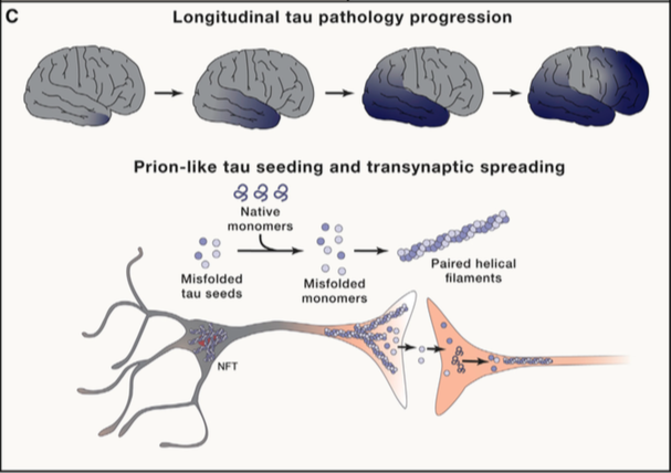 daperezm's tweet photo. Estupenda revisión en la revista Cell sobre los avances en la fisiopatología de la Enf. Alzheimer y las nuevas líneas terapéuticas: incluye la implicación neuroinmunidad o el papel del sueño. 
Imprescindible 😉 #Alzheimer 
https://t.co/kCjiFVL1Wn https://t.co/oFzSrlXorW