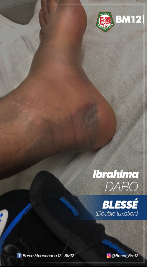Barea_Bm12's tweet photo. DABO Arthur Ibrahima 🇲🇬

Blessé (voir photo ci-dessus) notre gardien international n'a pas pu disputer la rencontre d'aujourd'hui.
Du coup notre portier chez les Barea ... 👉https://t.co/2R2PYdXBYI

.
#Ibrahima #Dabo #Barea
#BM12 #Madagasikara
BAREA Mpanohana faha 12 - BM12 https://t.co/i1TnQq7G6Y