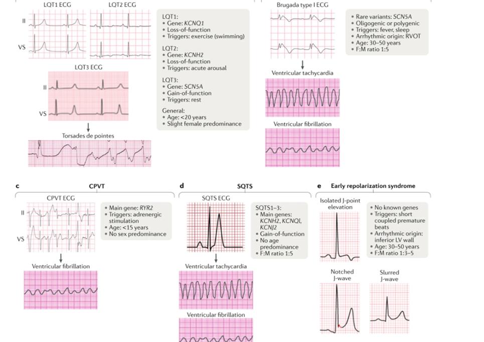 Check out our new Review on epidemiology of inherited primary rhythm disorders by Wilde and colleagues ($) nature.com/articles/s4156…